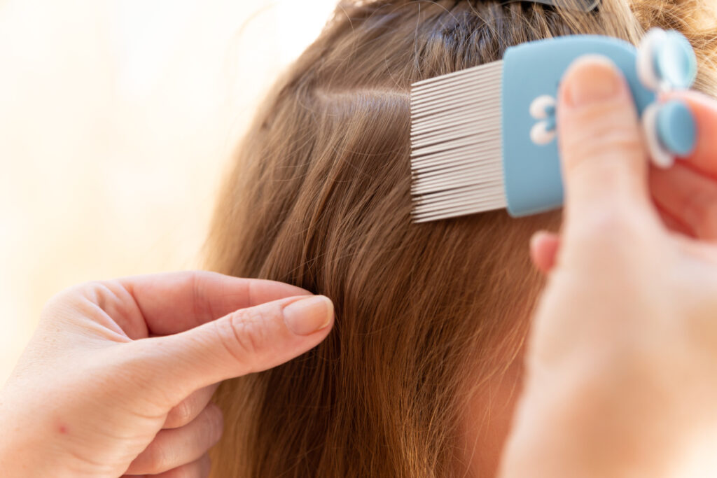 Talk To Your PharmaChoice Pharmacist About Treatment for Head Lice