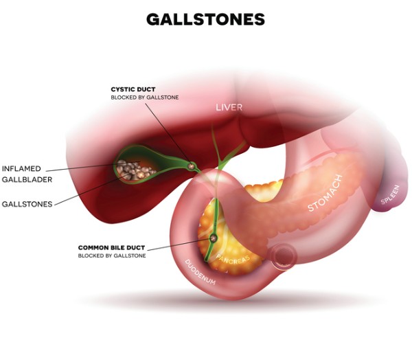 Talk to your PharmaChoice pharmacist today to learn more about gallbladder pain.