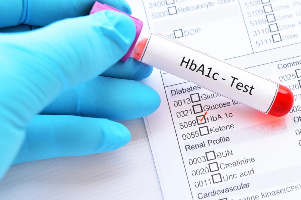 Learn about the tests for insulin resistance, and how to know if you're insulin resistant. Talk to your pharmacist to learn more.