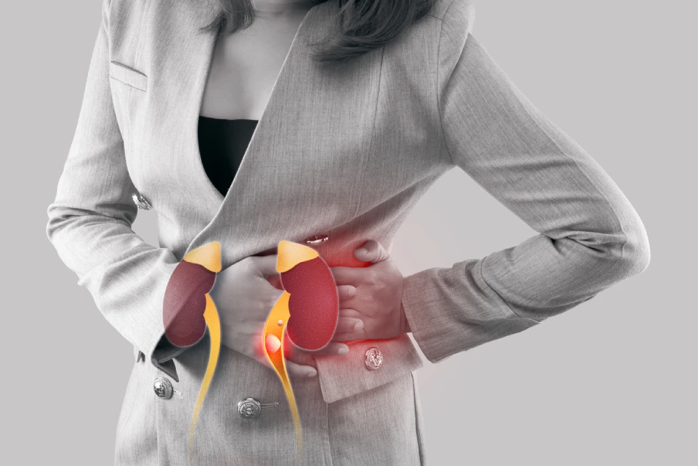 Talk to your PharmaChoice pharmacist to learn more about kidney stones symptoms