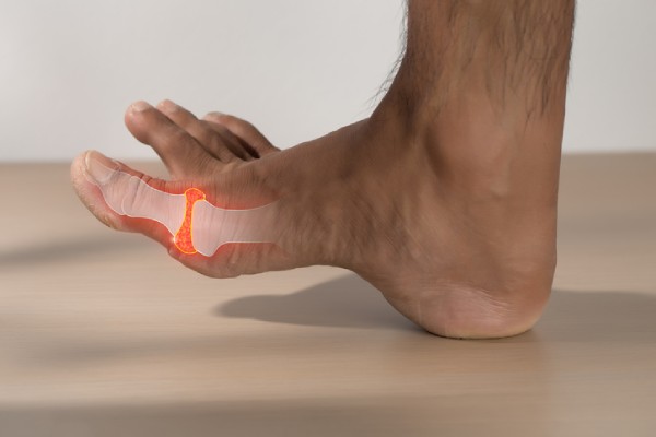 Learn more about what causes gout in feet at your local PharmaChoice Pharmacy today.