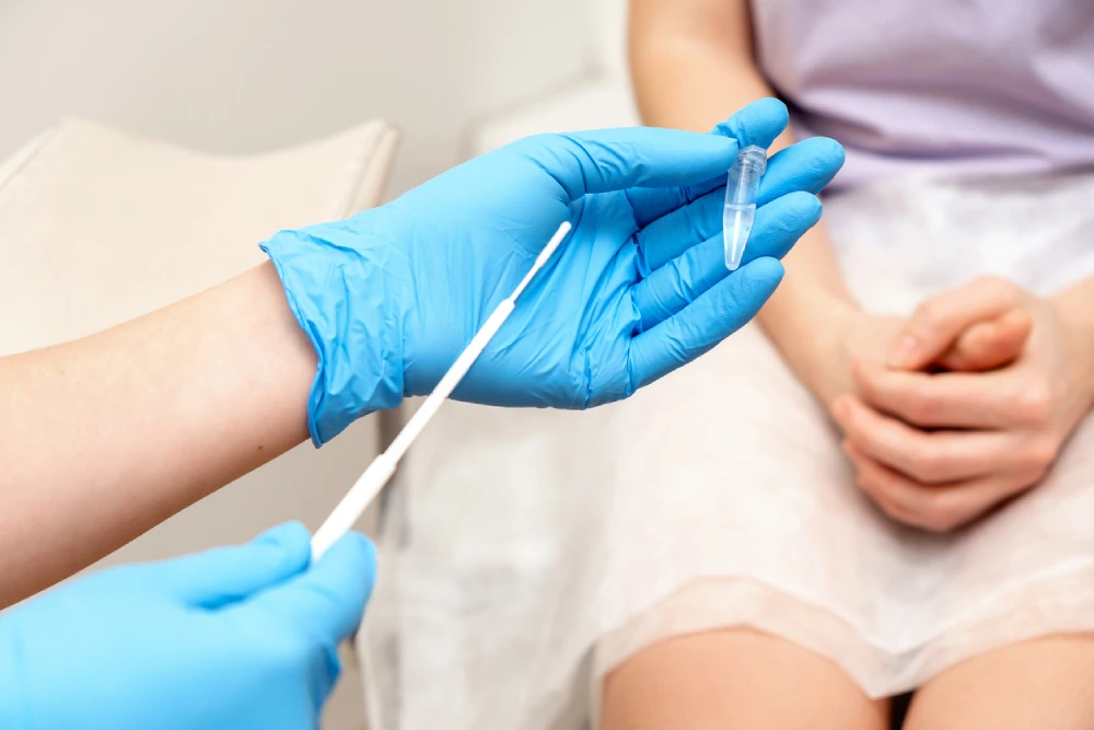 Chlamydia testing women