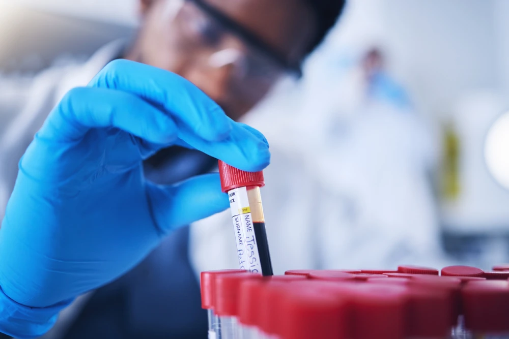 HIV blood test